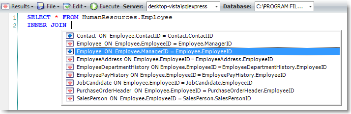 SQL Editor JOIN completion